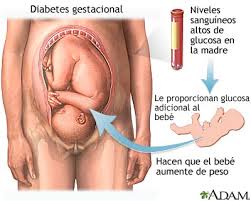consecuencias de una diabetes gestacional